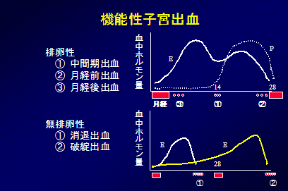 機能性子宮出血